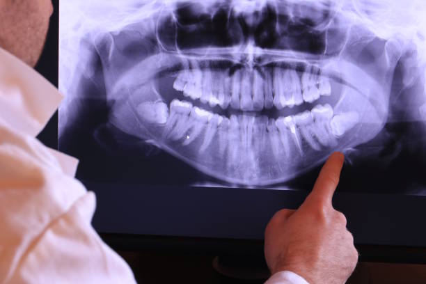 Best Weekend Emergency Dentist in New Lenox, IL