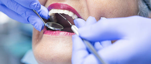 Best Emergency Tooth Extraction in New Lenox, IL